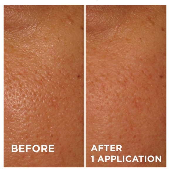 Brand New & Sealed - Dr. Brandt® POREDERMABRASION® - Picture 6 of 13